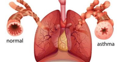 asma